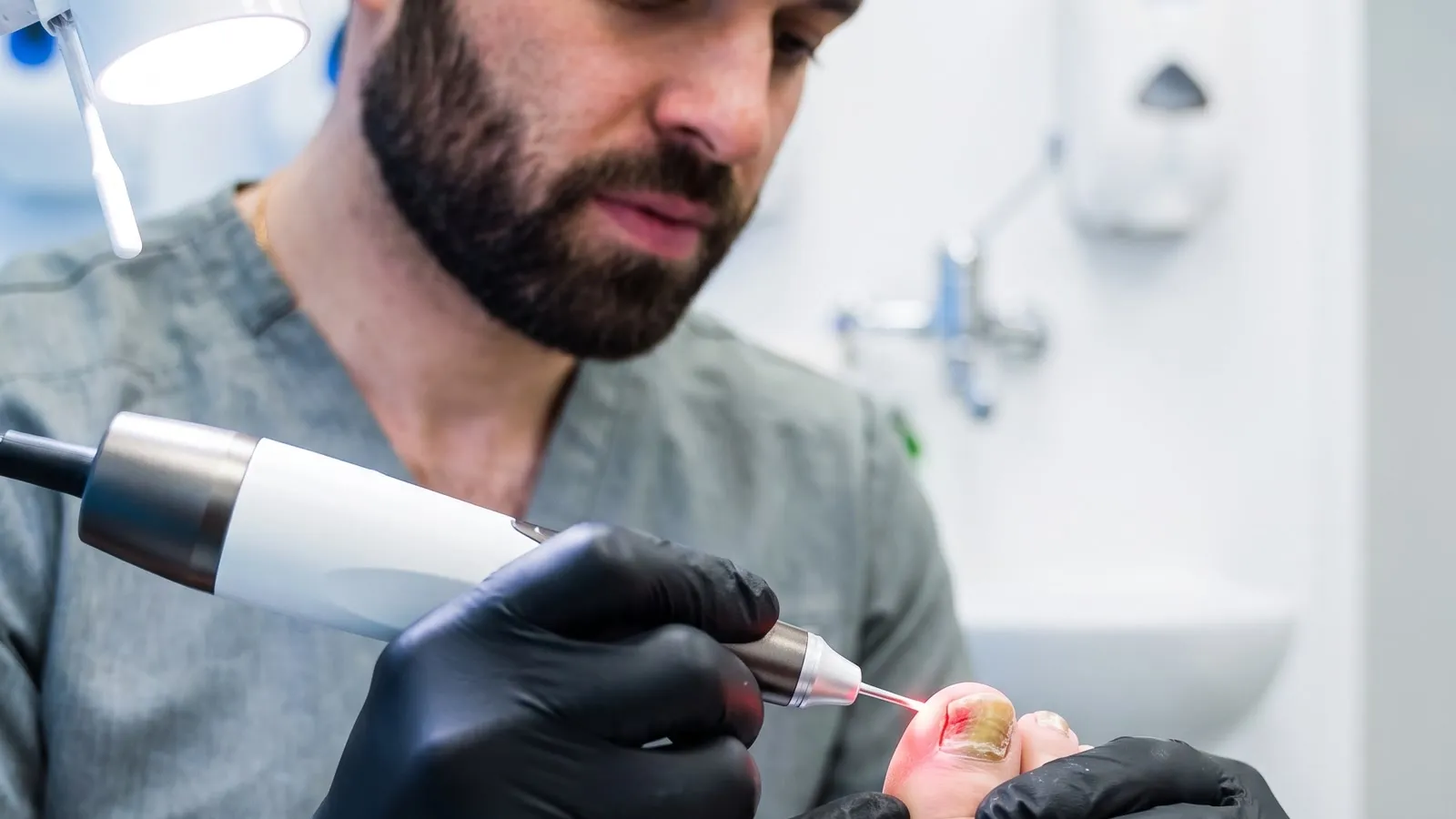 Illustration of laser application to a toenail