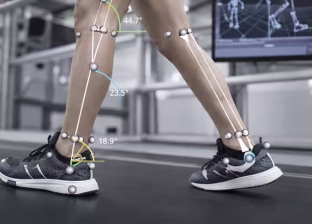 Run3D biomechanics equipment used for clinical gait analysis
